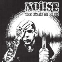 Noi!se – The Scars We Hide (Color Vinyl LP)